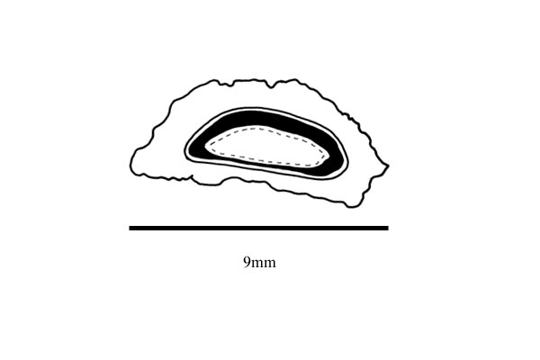 Embryo drawing